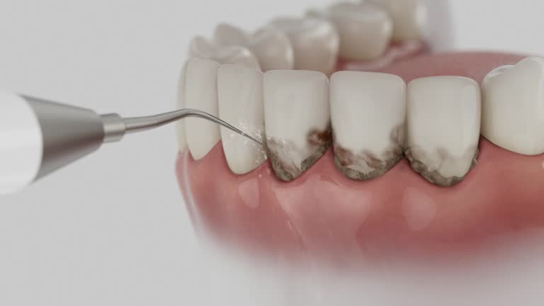 Reliable Dental Implants contractor in Chesapeake, OH by Smile Center Dentistry